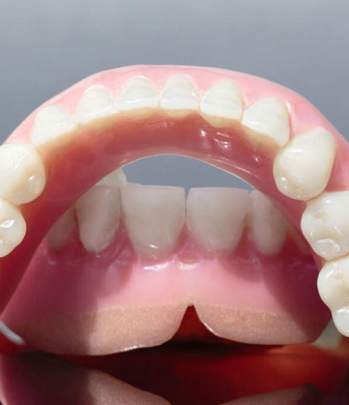 Denture Treatment 